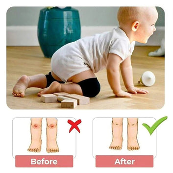 Baby Crawling Knee Pads for Babies | Anti-Slip Knee Protectors | Soft Cotton Knee Guards | 10 Pairs (20 Pieces) | Multicolor | BabyCove